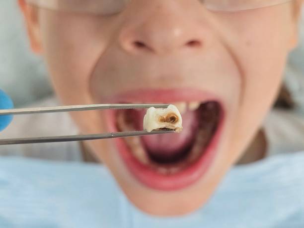 Best Urgent Dental Care for Toothache in Eidson Road, TX