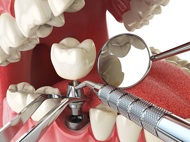 Best Broken or Cracked Tooth Emergency Dentist in Eidson Road, TX